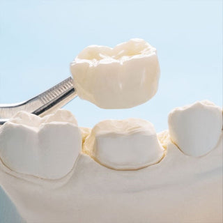 Influencing factors of aesthetic prosthesis performance of monolithic zirconia crowns