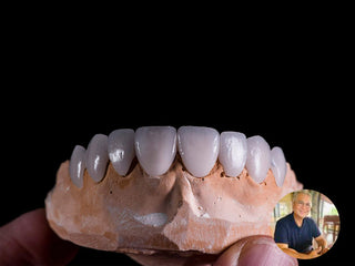 Case Author: Eduardo From Mexico Material: Lithium Disilicate  Model: BL4