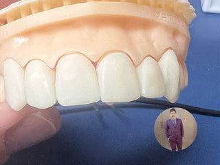 Case Author: Thomas  From：Mexico Material: Lithium-Disilicate-Ingot