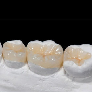 Effect analysis of ceramic onlay to repair serious dental defects in young permanent molars