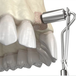 What are the effects of bite and thickness design on the fracture resistance of lithium disilicate ceramic restored root canal crowns?