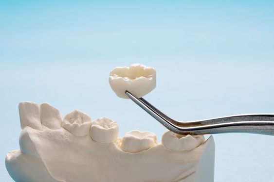 What is the effect of bite and thickness design on the fracture resistance of lithium disilicate ceramics and zirconia restored root canal crowns?