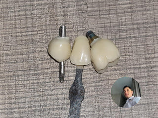 2024-08-31 case:    From Chile     Author: Andre      Material: ST+ML