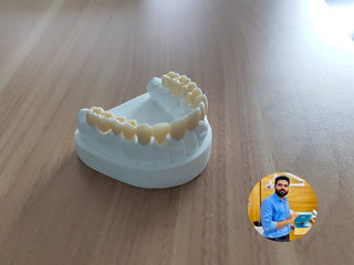 2024-12-06 case:   From:Mexico   Author:Jesus  Material:ST+Multilayer zirconia