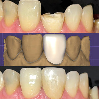 3D Pro Multilayer Zirconia Block Zirkonzahn System 95mm