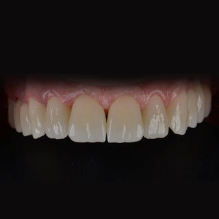 ST+Color Precolored Zirconia Block Sirona System  5 Pieces