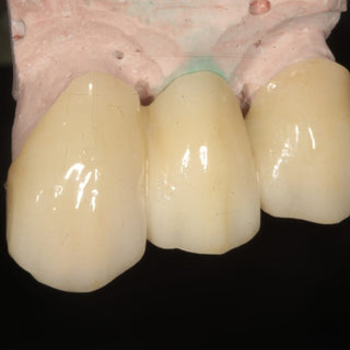 ST+Multilayer Zirconia Block Sirona System