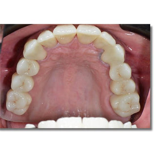 ST+Color Precolored Zirconia Block Open System 98mm