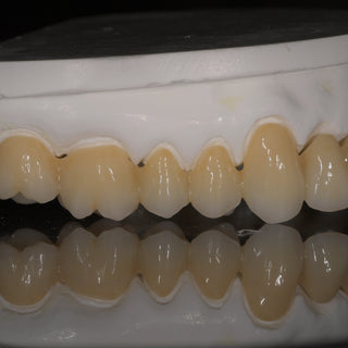 zirconia dental implants