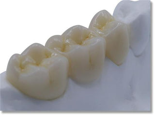 ST+ White Zirconia Block AG System  71mm