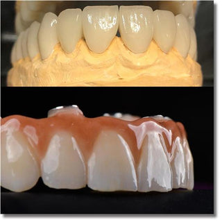 UTEx Pro Zirconia Multicapa Color Bloque OM